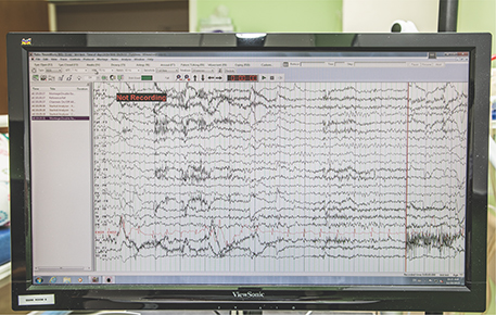 An EEG recording obtained during a clinical trial.
