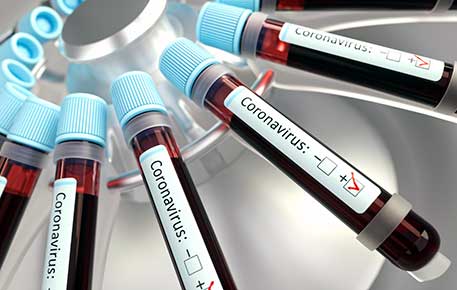 testtubes for coronavirus testing