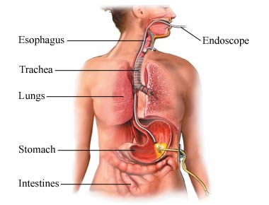 endoscope passing through upper digestive tract