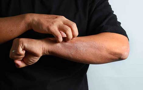 this man's arm has itchy skin that could be cancer