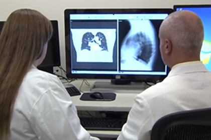 lung cancer doctors reviewing scans