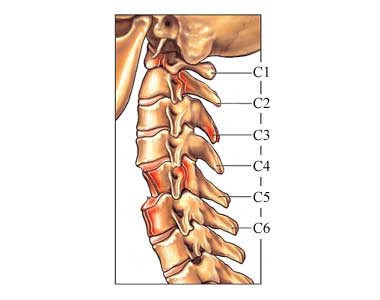 neck fracture diagram