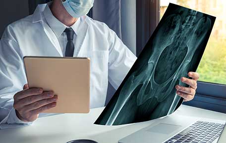uva health joint replacement surgeon reviewing x-rays for second opinion
